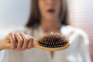 hair loss